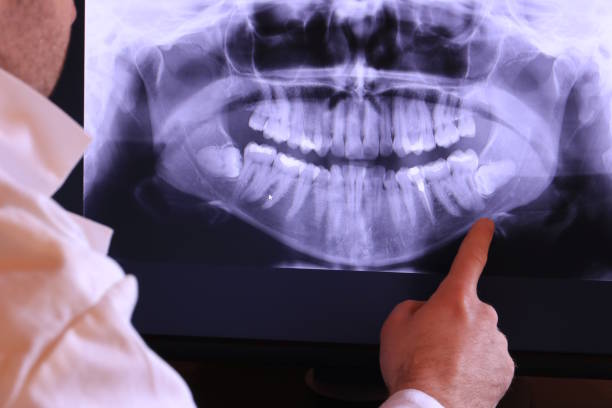 Best Knocked-Out Tooth Emergency  in Landmk, AR