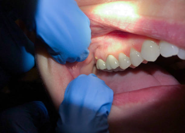 Best Broken Tooth Emergency  in Landmk, AR