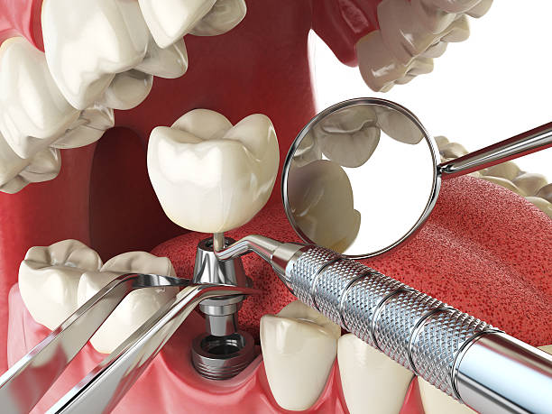 Best Urgent Tooth Repair  in Landmk, AR
